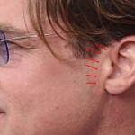 Brad Pitt plastic surgery facelift scar (27)