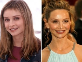 Calista Flockhart before and after plastic surgery (10)
