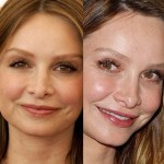 Calista Flockhart before and after plastic surgery (17)