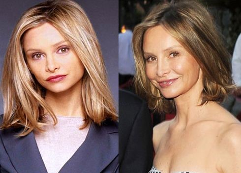 Calista Flockhart before and after plastic surgery (20)