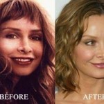 Calista Flockhart before and after plastic surgery (24)