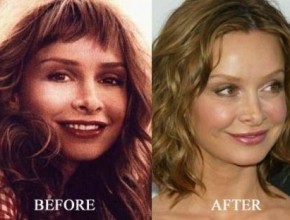 Calista Flockhart before and after plastic surgery (24)