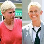 Ellen DeGeneres before and after plastic surgery (11)