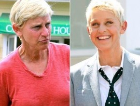 Ellen DeGeneres before and after plastic surgery (11)