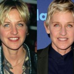 Ellen DeGeneres before and after plastic surgery