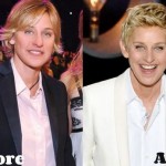 Ellen DeGeneres before and after plastic surgery (9)