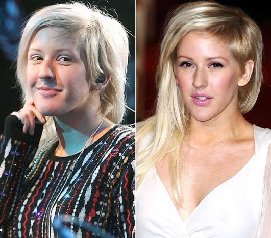 Ellie Goulding after breast augmentation (24)