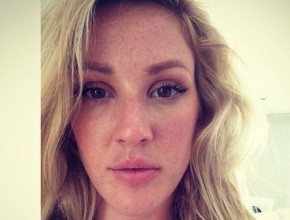 Ellie Goulding plastic surgery (29)