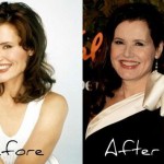 Geena Davis after plastic surgery (9)