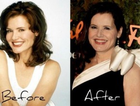 Geena Davis after plastic surgery (9)