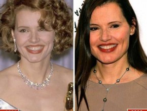 Geena Davis before and after plastic surgery (1)