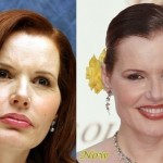 Geena Davis before and after plastic surgery (11)