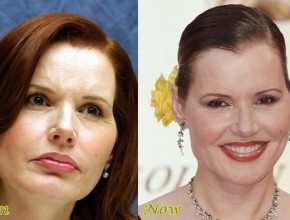 Geena Davis before and after plastic surgery (11)