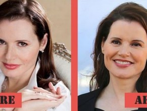 Geena Davis before and after plastic surgery (13)