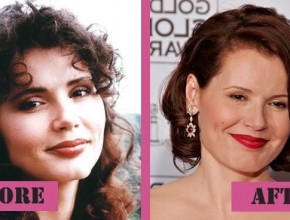 Geena Davis before and after plastic surgery
