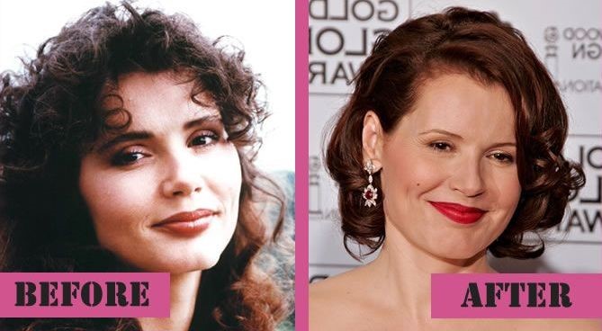 Geena Davis before and after plastic surgery