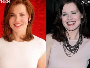 Geena Davis plastic surgery - then and now (4)
