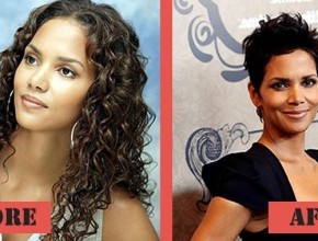 Halle Berry before and after plastic surgery (21)