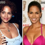 Halle Berry before and after plastic surgery