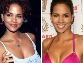 Halle Berry before and after plastic surgery