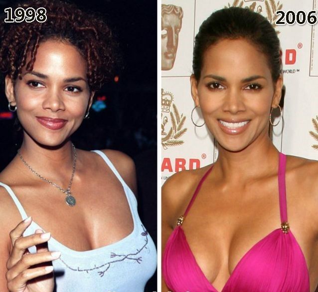 Halle Berry before and after plastic surgery