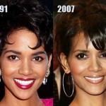 Halle Berry before and after plastic surgery (28)