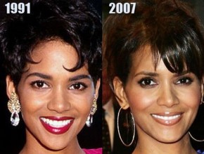 Halle Berry before and after plastic surgery (28)