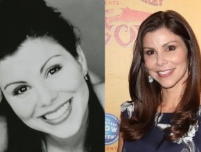Heather Dubrow before and after Plastic Surgery (19)