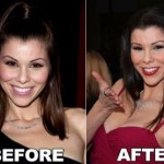 Heather Dubrow before and after Plastic Surgery (25)