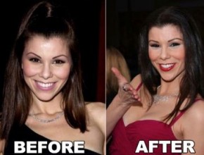 Heather Dubrow before and after Plastic Surgery (25)