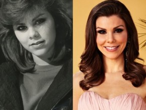 Heather Dubrow before and after Plastic Surgery