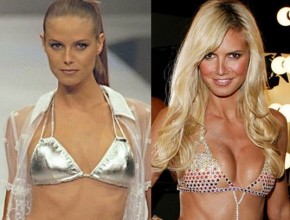 Heidi Klum before and after plastic surgery (19)