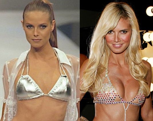 Heidi Klum before and after plastic surgery (19)