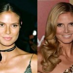 Heidi Klum before and after plastic surgery (20)