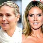 Heidi Klum before and after plastic surgery (30)