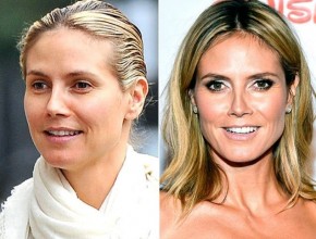 Heidi Klum before and after plastic surgery (30)