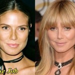 Heidi Klum nose job plastic surgery (22)