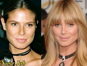 Heidi Klum nose job plastic surgery (22)