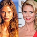 Heidi Klum then and now plastic surgery (25)
