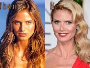 Heidi Klum then and now plastic surgery (25)