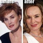 Jessica Lange before and after plastic surgery (17)
