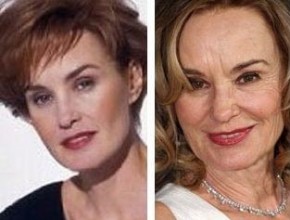 Jessica Lange before and after plastic surgery (17)