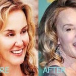 Jessica Lange before and after plastic surgery (23)