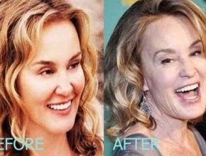 Jessica Lange before and after plastic surgery (23)