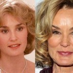 Jessica Lange before and after plastic surgery (25)