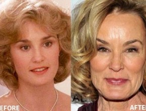 Jessica Lange before and after plastic surgery (25)