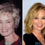 Jessica Lange before and after plastic surgery (26)