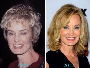 Jessica Lange before and after plastic surgery (26)