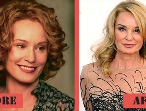 Jessica Lange before and after plastic surgery (28)