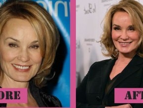 Jessica Lange before and after plastic surgery (29)